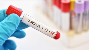 Direcția de Sănătate Publică: două decese și 66 cazuri noi de persoane infectate cu SARS CoV-2