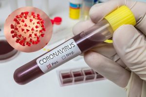 Un deces şi 71 cazuri noi de persoane infectate cu SARS CoV-2