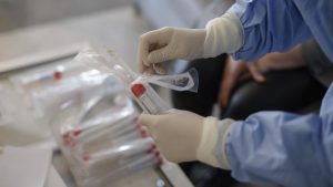 82 cazuri noi de persoane infectate cu SARS CoV-2