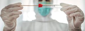 Astăzi a fost confirmat un caz de reinfectare cu Covid 19